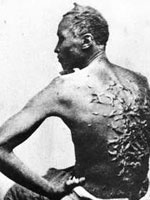 Photo, Slave named Gordon with whip scars, Wounds inflicted December 25, 1862